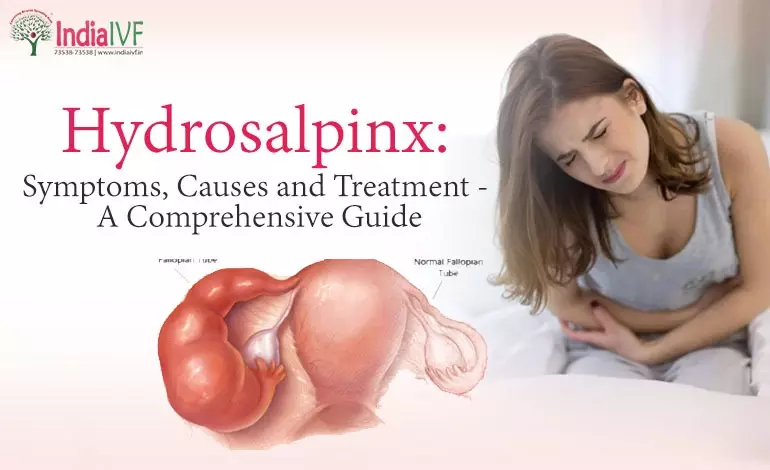 Hydrosalpinx: Symptoms, Causes and Treatment – A Comprehensive Guide