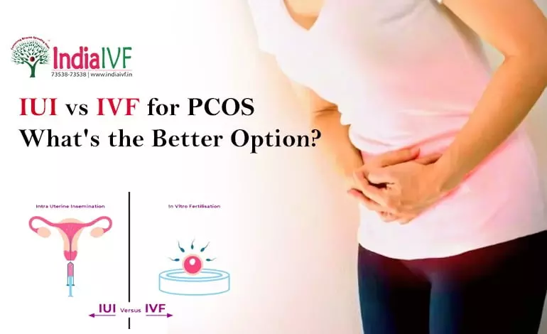 IUI-vs-IVF-for-PCOS
