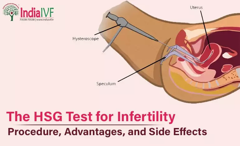 The HSG Test for Infertility – Procedure, Advantages, and Side Effects