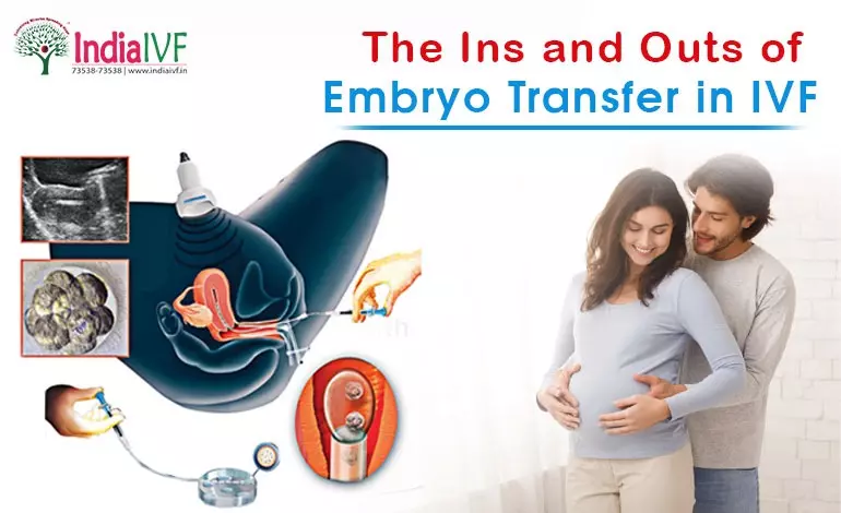 The Ins and Outs of Embryo Transfer in IVF: A Comprehensive Guide by India IVF Fertility