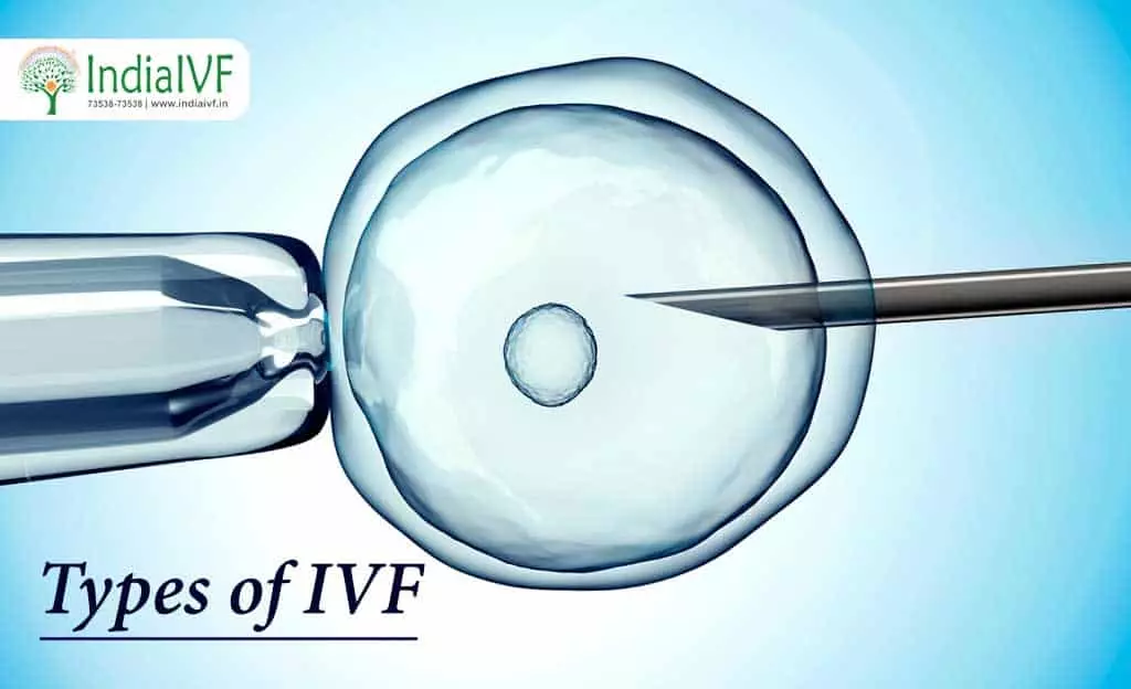 Natural Cycle IVF