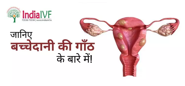 fibroid-in-uterus