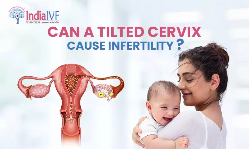 Understanding the Impact of a Tilted Cervix on Fertility