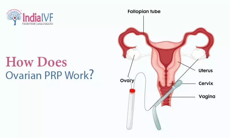 How Does Ovarian PRP Work