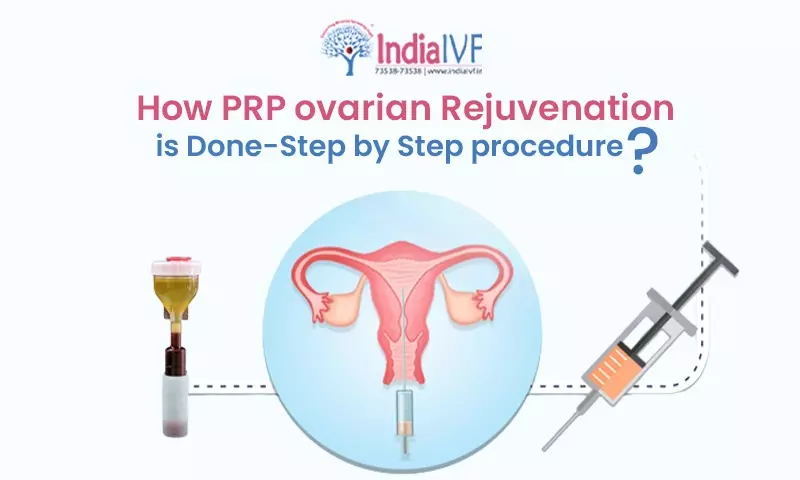 How PRP ovarian rejuvenation is Done-Step by Step procedure?