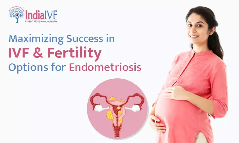 Maximizing Success in IVF & Fertility Options for Endometriosis: A Comprehensive Step-by-Step Guide