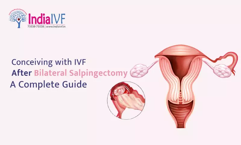 IVF After Bilateral Salpingectomy