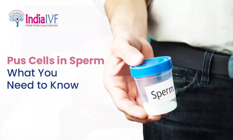 Pus Cells in Sperm: What You Need to Know