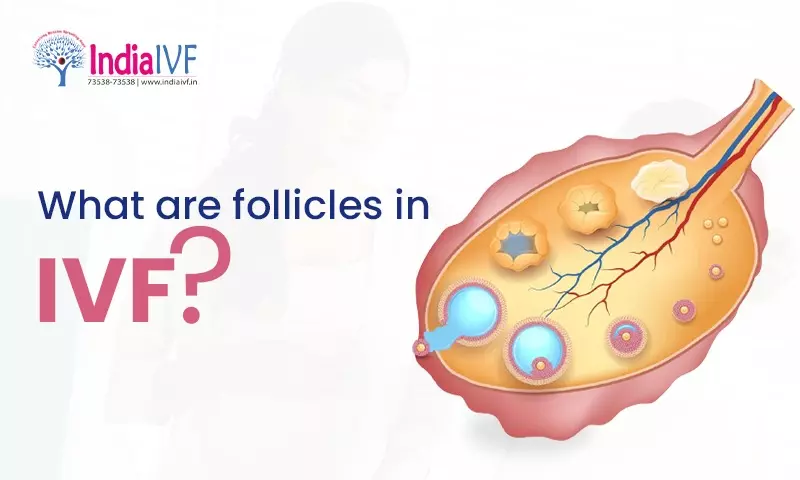 What are follicles in IVF?