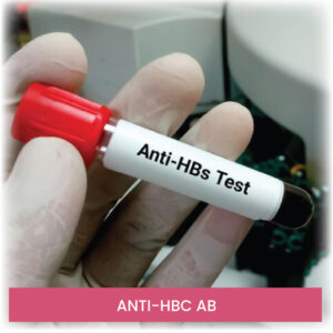 ANTI-HBC AB