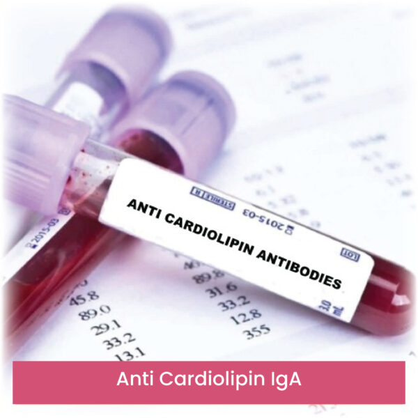Anti Cardiolipin IgA
