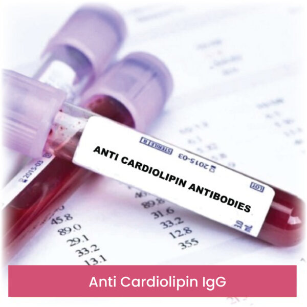 Anti Cardiolipin IgG