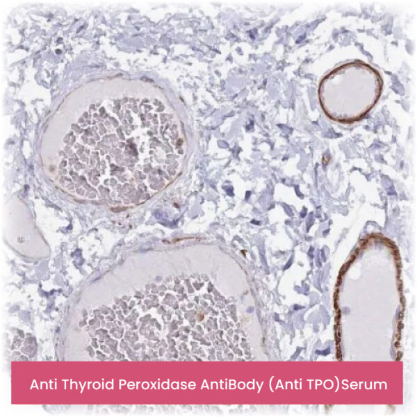 Anti Thyroid Peroxidase AntiBody (Anti TPO)Serum