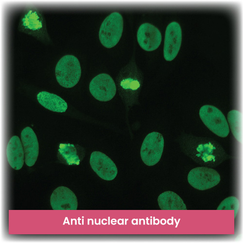Anti nuclear antibody