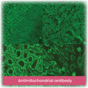 Antimitochondrial antibody