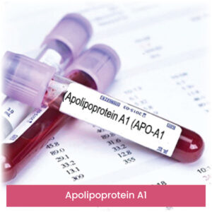 Apolipoprotein A1