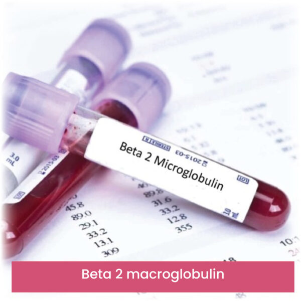 Beta 2 macroglobulin