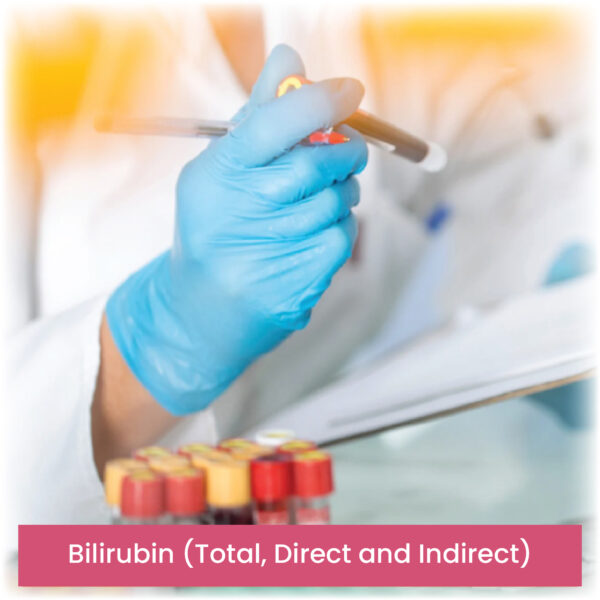 Bilirubin (Total, Direct and Indirect)