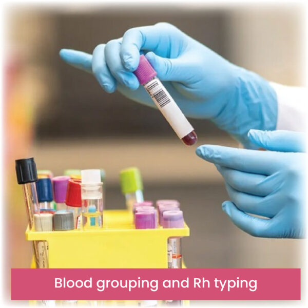Blood grouping and Rh typing