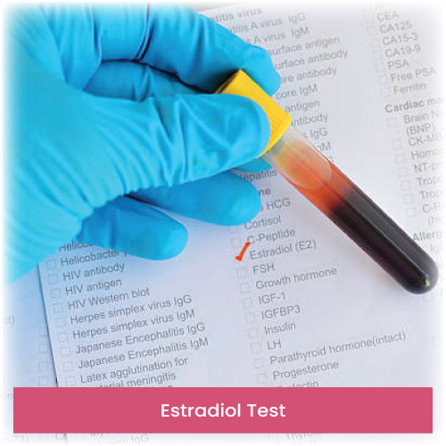 Estradiol Test