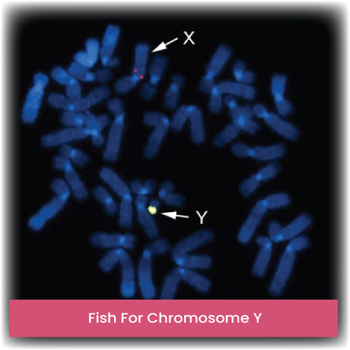 Fish For Chromosome Y