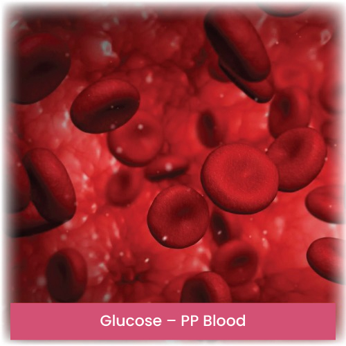 Glucose – PP Blood