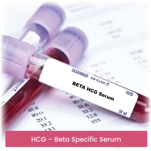 HCG – Beta Specific Serum