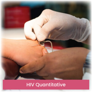HIV Quantitative