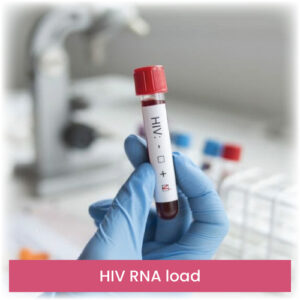 HIV RNA load