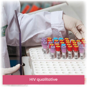 HIV qualitative
