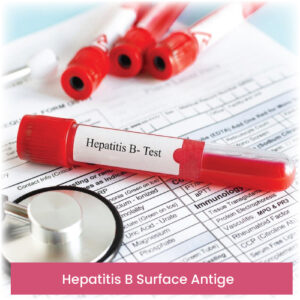 Hepatitis B Surface Antige