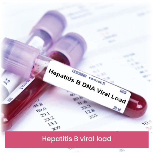 Hepatitis B viral load