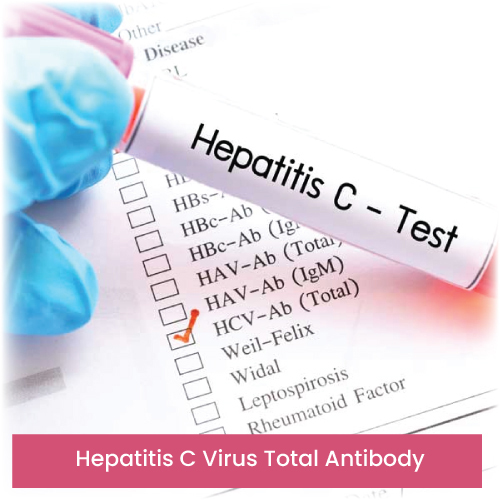 Hepatitis C Virus Total Antibody