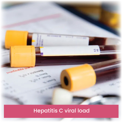 Hepatitis C viral load