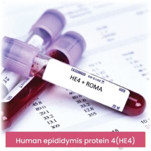 Human epididymis protein 4(HE4)