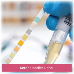 Ketone bodies urine