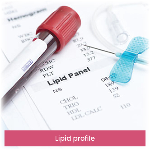 Lipid profile