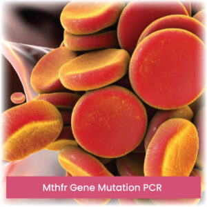 Mthfr Gene Mutation PCR