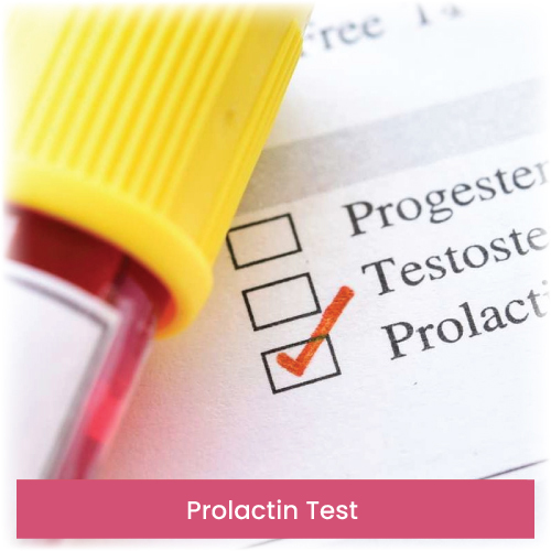 Prolactin Test
