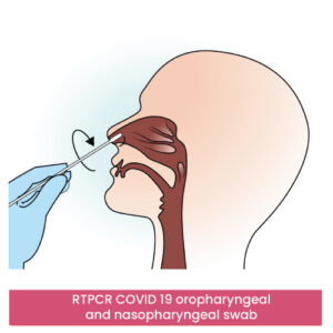 RTPCR COVID 19 oropharyngeal and nasopharyngeal swab