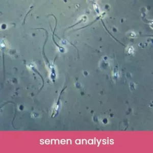 Semen-analysis