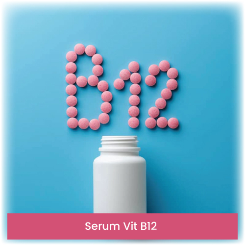 Serum Vit B12