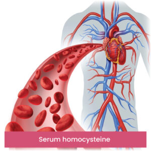 Serum homocysteine
