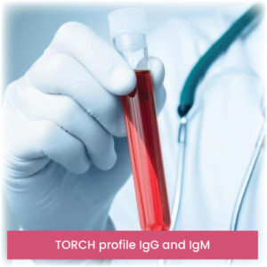 TORCH profile IgG and IgM