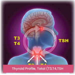 Thyroid Profile, Total (T3,T4,TSH)
