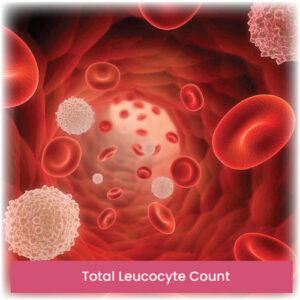 Total Leucocyte Count