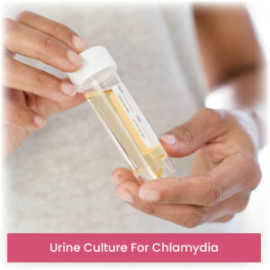 Urine Culture For Chlamydia