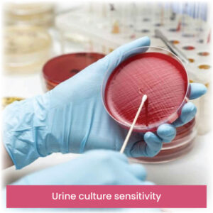 Urine culture sensitivity