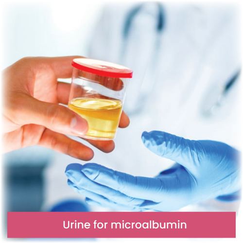 Urine for microalbumin