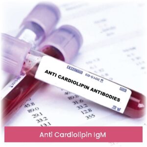 Anti Cardiolipin IgM